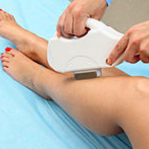 Consultation (IPL)